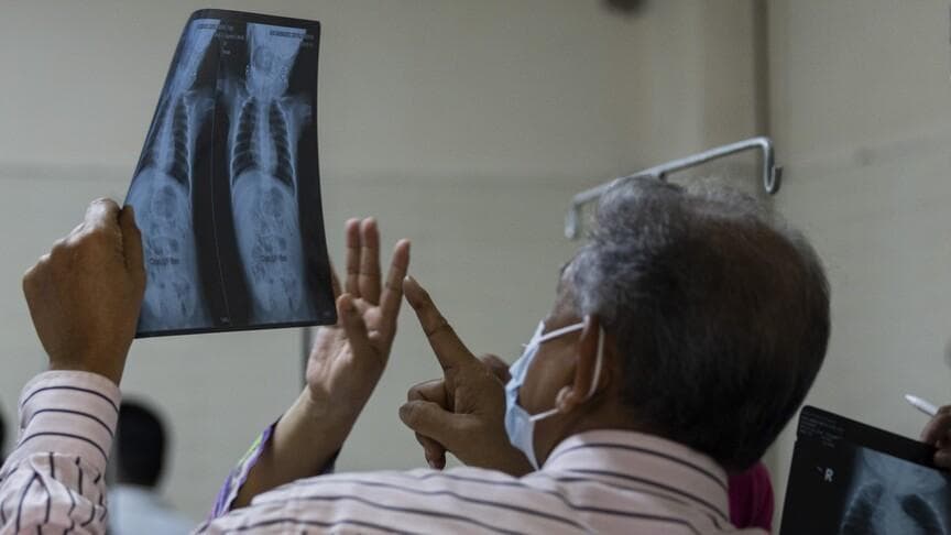 Deaths linked to measles rise to 1,030 in Bangladesh