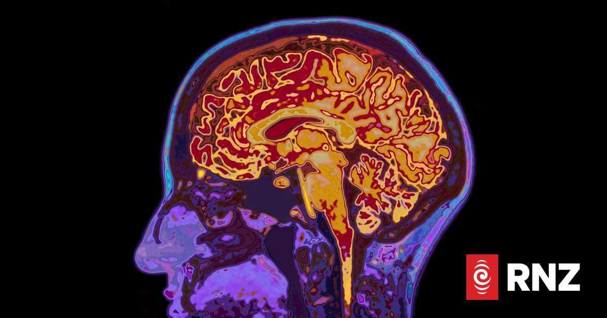 Alzheimer's disease is starting to be considered a treatable condition
