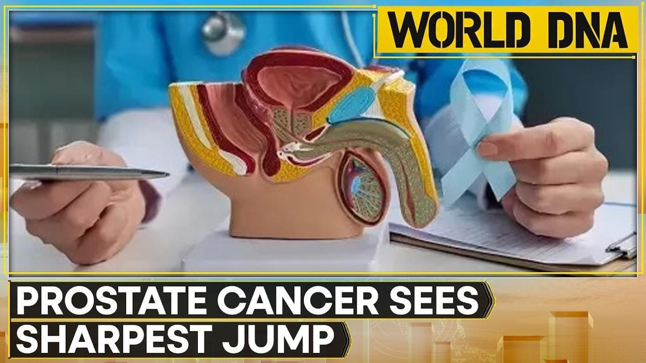 Prostate Cancer Cases See Sharpest Rise, Global Study Finds | WION World DNA
